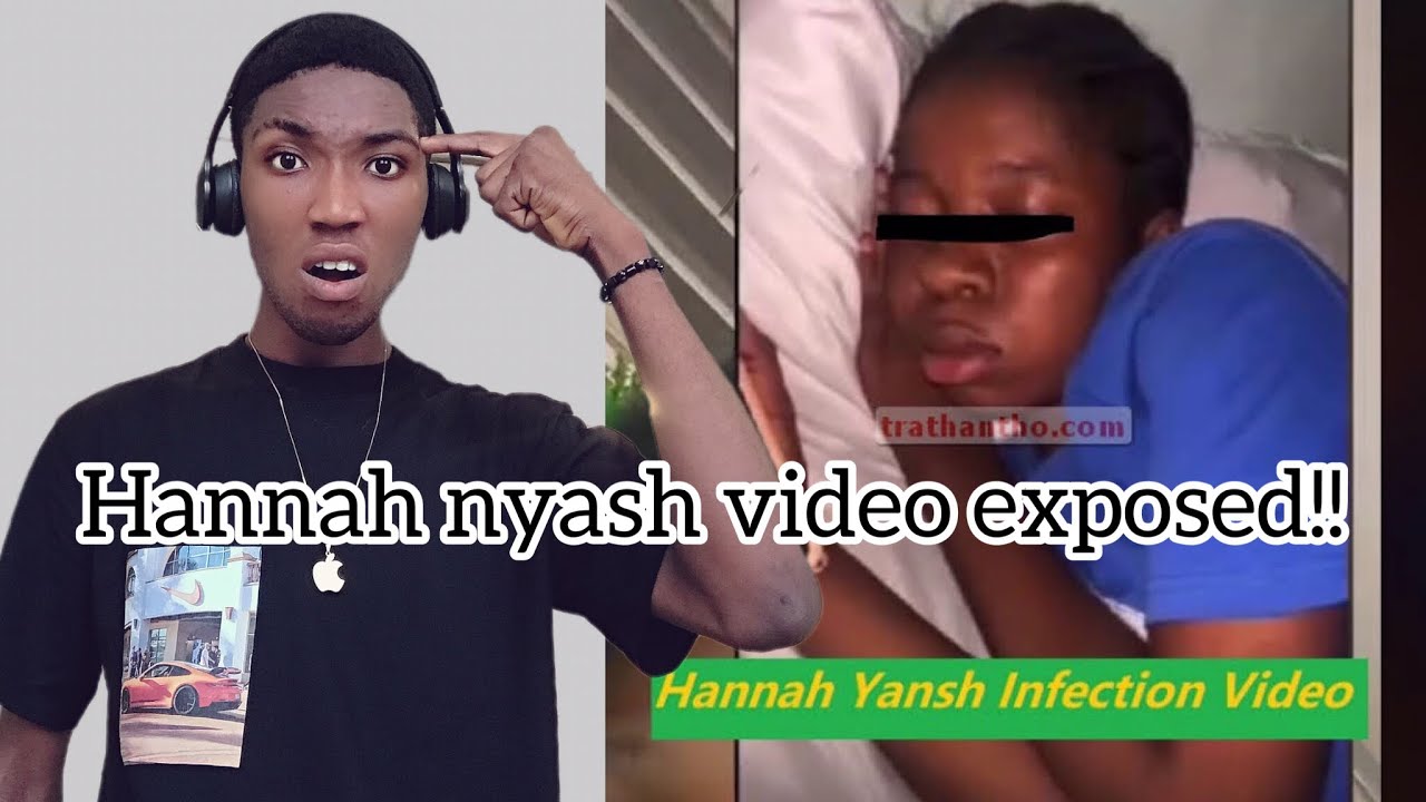 Hannah Yansh's Infection