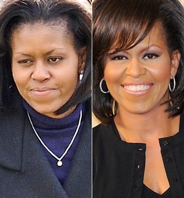 Michelle Obama’s Nose Job 2